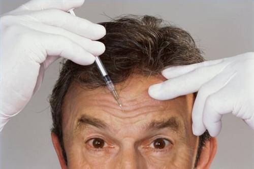 Cómo tratar las migrañas con Botox