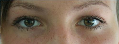 Acerca de la arruga del ojo Reductores