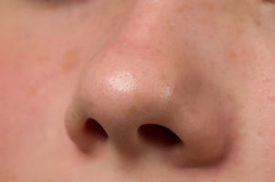 Cómo controlar las espinillas en la nariz