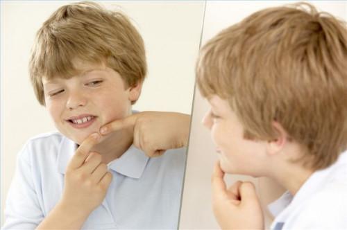 Cómo prevenir el acné adolescente